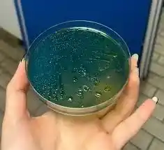 محیط کشت TCBS AGAR