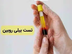 خرید بیلی روبین - Bilirubin 36 بیلی روبین - Bilirubin