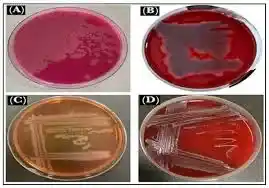 محیط کشت لینکومایسین آگار