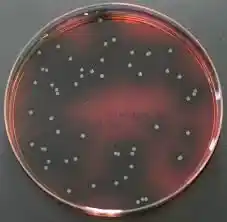 خرید محیط کشت پالکام آگار